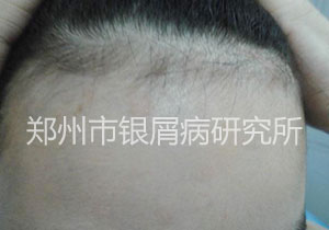 幸遇良医 女孩第一次绽放笑容