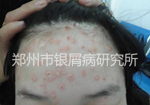健康还复来：当疾病邂逅规范治疗