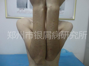 健康还复来：当疾病邂逅规范治疗