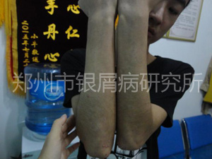 健康还复来：当疾病邂逅规范治疗