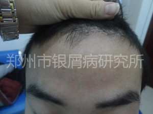 健康还复来：当疾病邂逅规范治疗