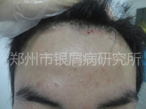 健康还复来：当疾病邂逅规范治疗