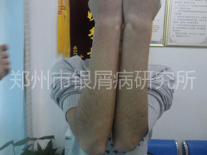 健康还复来：当疾病邂逅规范治疗