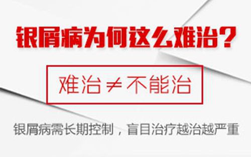 专家介绍：银屑病治疗与季节有关-2.jpg